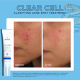 Clear Cell Clarifying Salicylic Blemish Gel