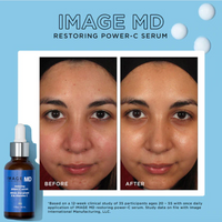 IMAGE MD RESTORING POWER-C SERUM